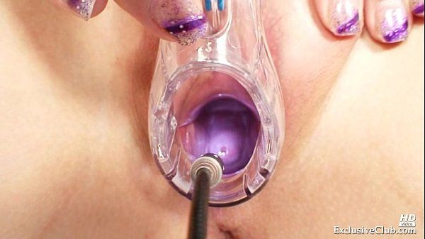 Zaneta has her pussy gyno speculum examined by old doctor - 1